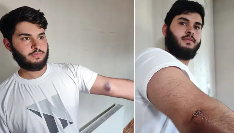 Bahçeye Kaçan Top, Mahallede Şok Etkisi Yarattı: Kamyonetle Geldiler!