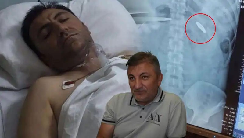 15 Temmuz’un Derin İzleri: Kurşunla Yaralı Hayatlar